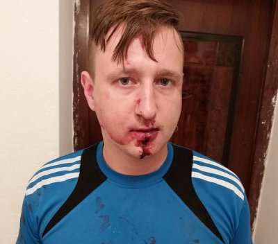 В Одессе неизвестные жестоко избили местного журналиста - «Новороссия»