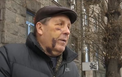 К делу об избиении авиаконструктора в Киеве подключилось ГБР - «Украина»