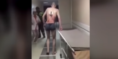 В Татарстане пациент с ножом в спине не дождался операции и отправился на перекур