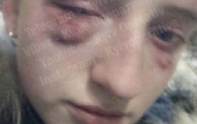 В Киеве жестоко избили школьницу - «Украина»