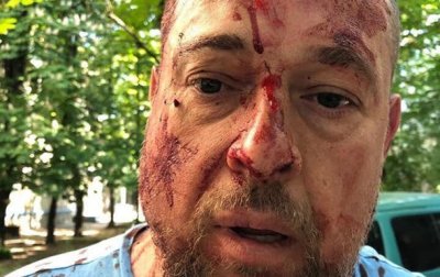 В Харькове неизвестные избили кастетами радикала украинского «Нацкорпуса» - «Новороссия»