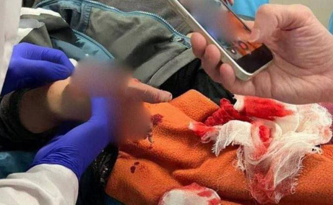 Десять рваных рублей: Мелкая купюра едва не лишила мальчика руки на детской площадке - «Происшествия»