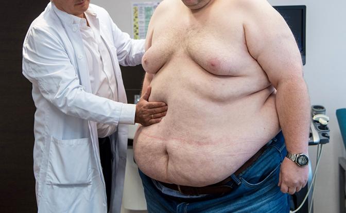 Слишком жирно — терять триллионы рублей из-за не в меру упитанных сограждан - «Здоровье»
