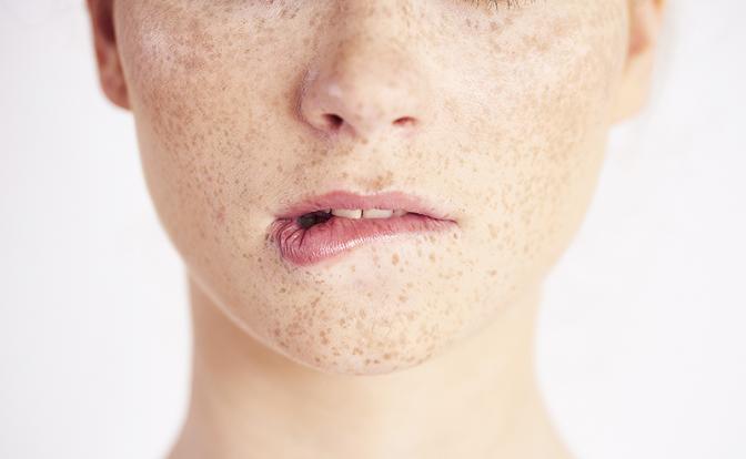 Что нужно знать о лазерной эпиляции при гиперпигментации и склонности к рубцеванию - «Здоровье»